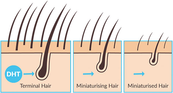 SOME BIZARRE REASONS THAT ARE MAKING YOUR HAIR SHED