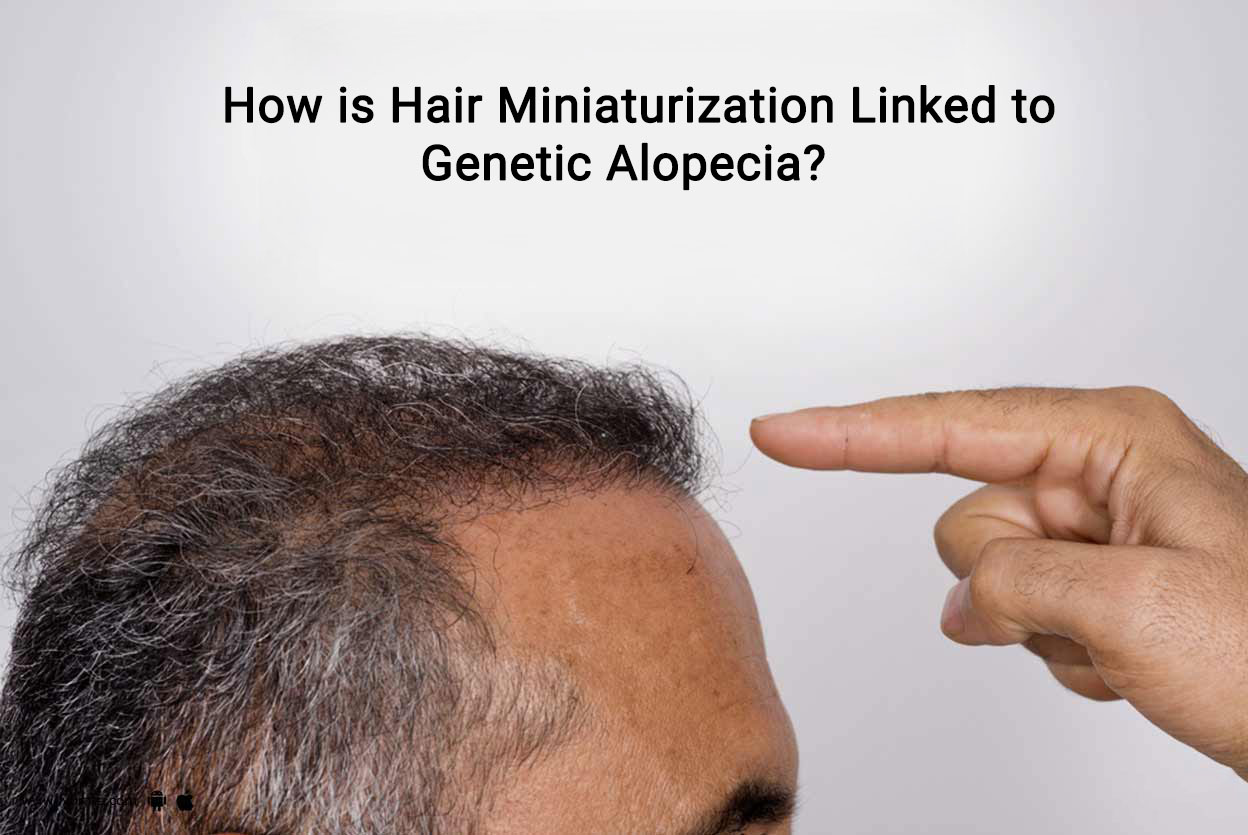 Is Hair Miniaturization Linked to Genetic Alopecia