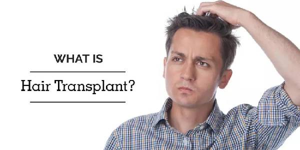 EVERYTHING YOU WANTED TO KNOW ABOUT HAIR TRANSPLANT