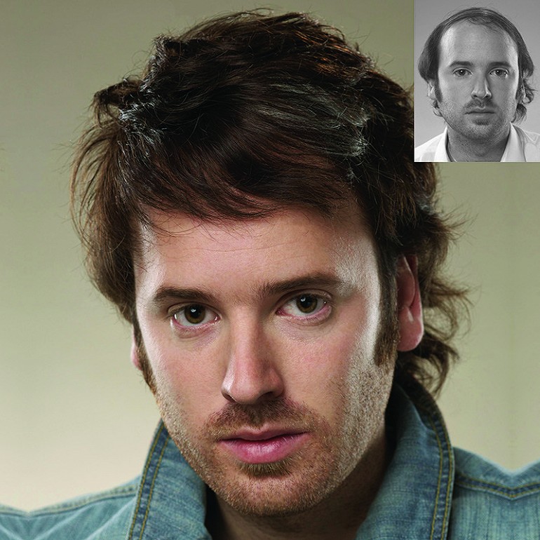 Hair transplant cost in dubai 4