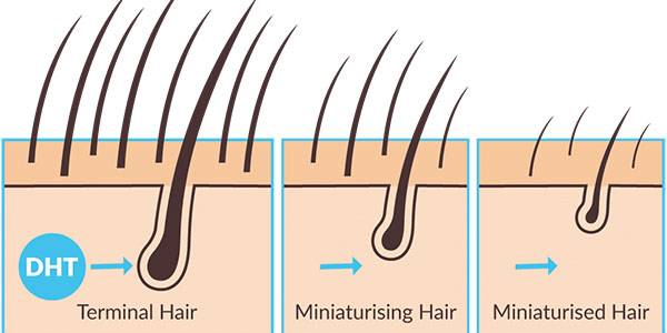 SOME BIZARRE REASONS THAT ARE MAKING YOUR HAIR SHED