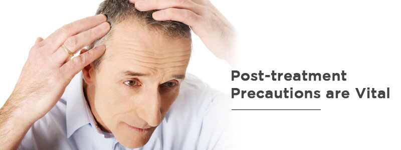 Important things you need to bear in mind before your Hair Transplant – UAE