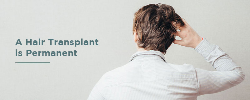 Important things you need to bear in mind before your Hair Transplant – UAE