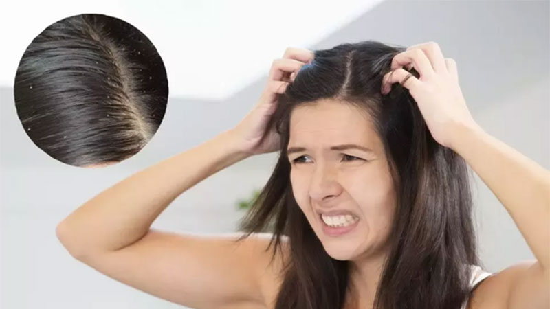 Top Reasons Why You Should Protect Your Hair